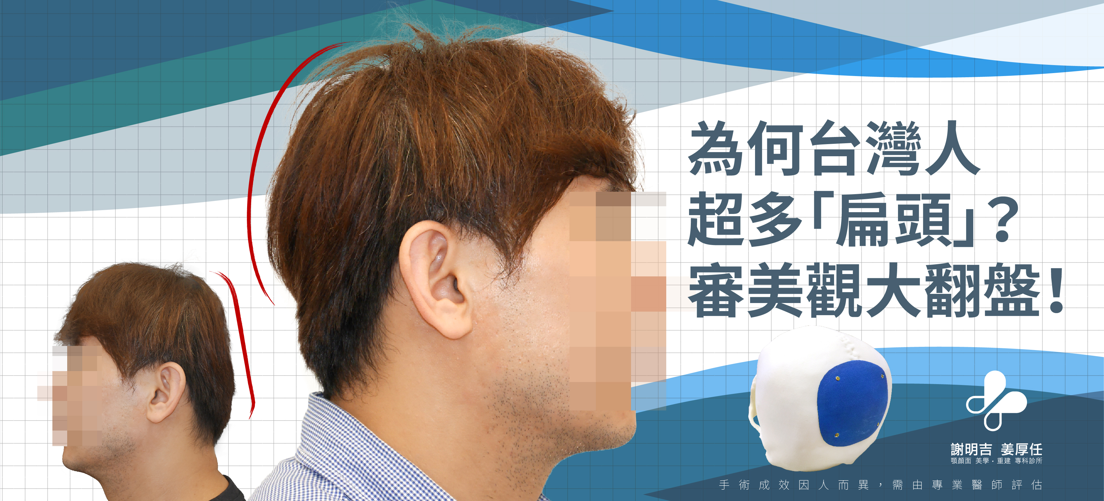 Why do so many Taiwanese people have "flat heads"? Aesthetic makeover!