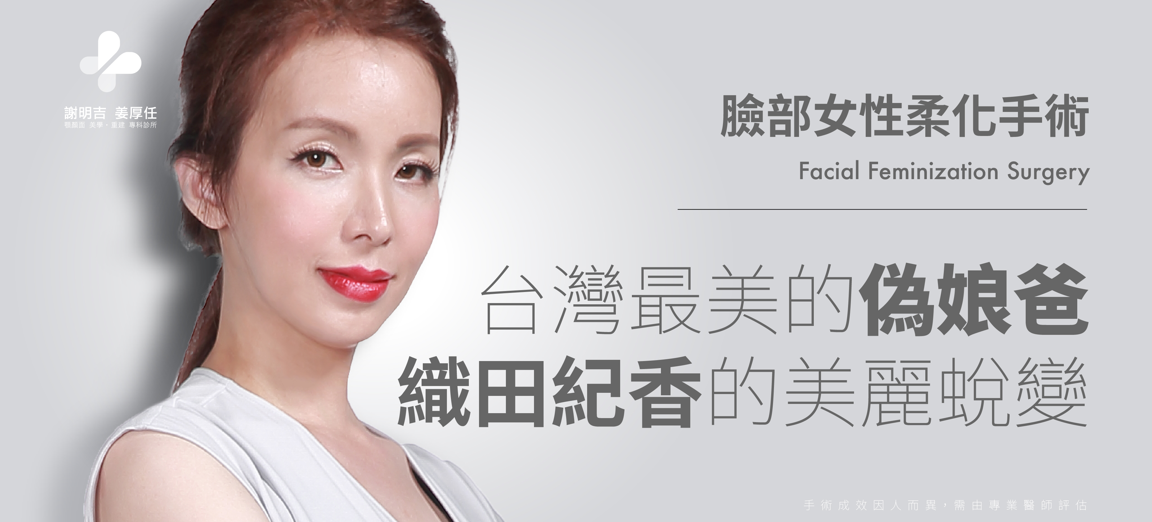 臉部女性柔化手術聞名國際謝明吉醫師 從心改造全新織田紀香