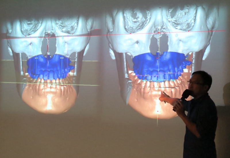  20150429 Modern Concepts in Facial-Driven Orthodontics and Orthognathic Surgery