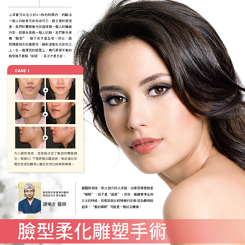 臉部柔化雕塑手術