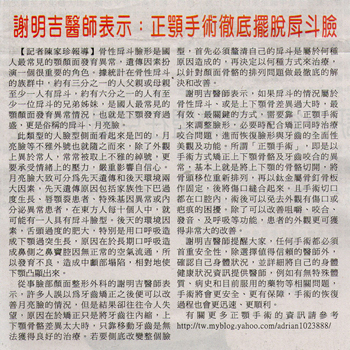 正顎手術徹底擺脫戽斗臉
