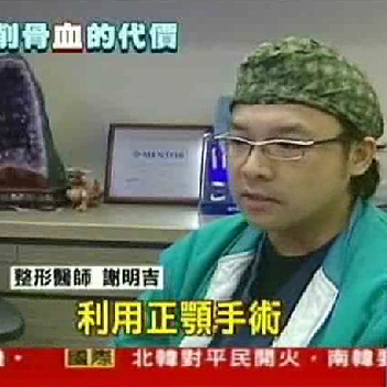 削骨變小臉「正妹」公開削骨手術經驗