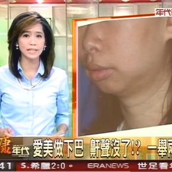 愛美做下巴　鼾聲沒了！一舉兩得