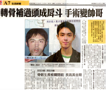 轉骨方喝過頭，國中開始長"戽斗"