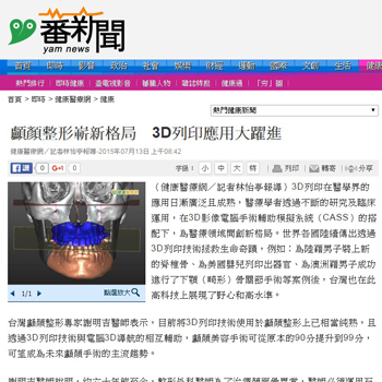 顱顏整形嶄新格局 3D列印應用大躍進