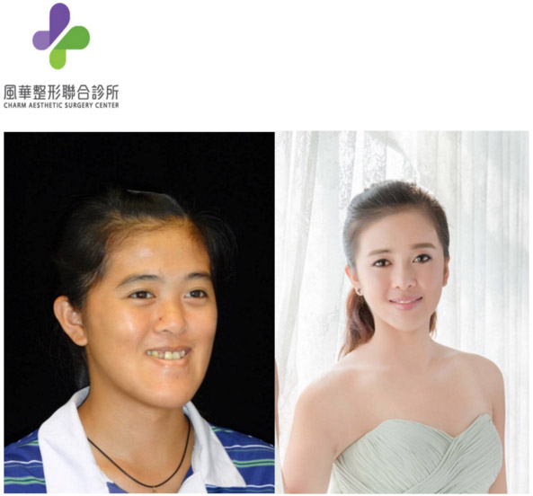 20151204~06 Contemporary Applications of Facial Skeletal Surgery photo 4