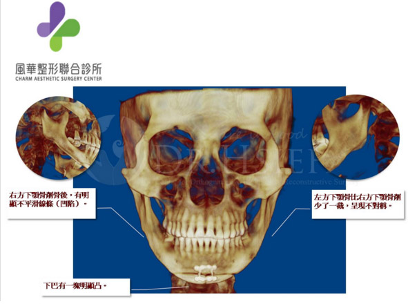 20151204~06 Contemporary Applications of Facial Skeletal Surgery photo 7