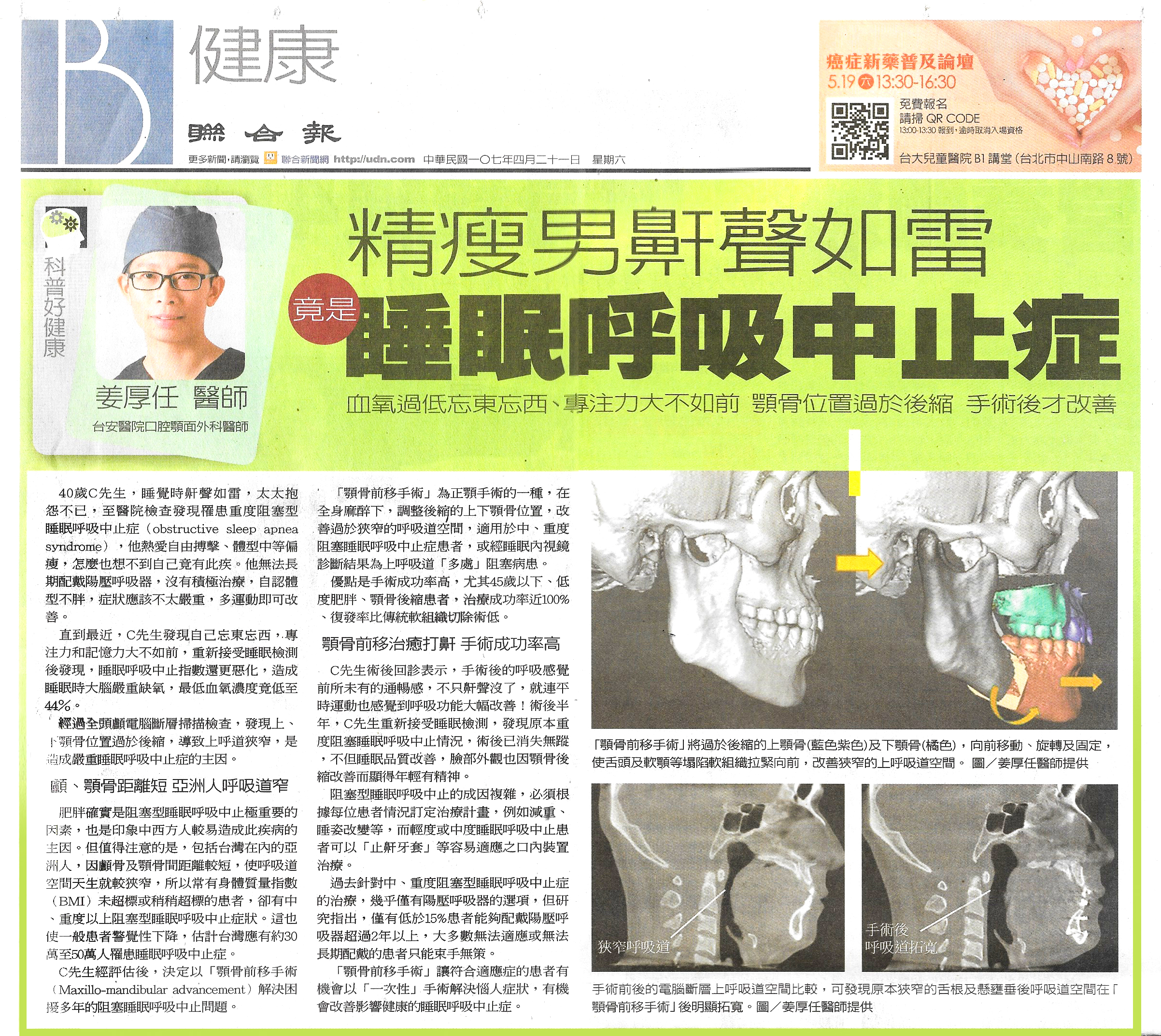 精瘦男鼾聲如雷 竟是睡眠呼吸中止症