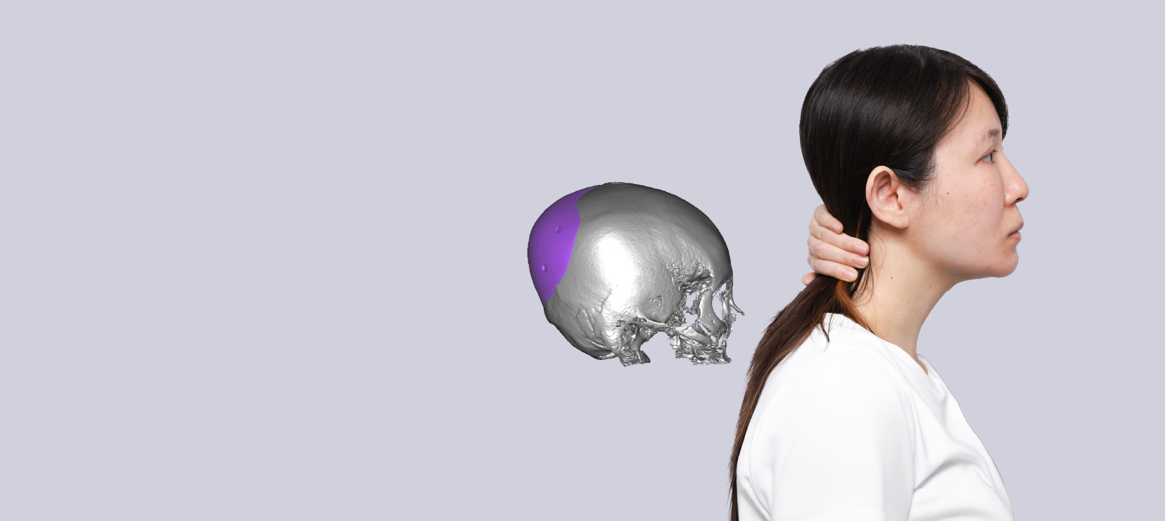 Occipital augmentation