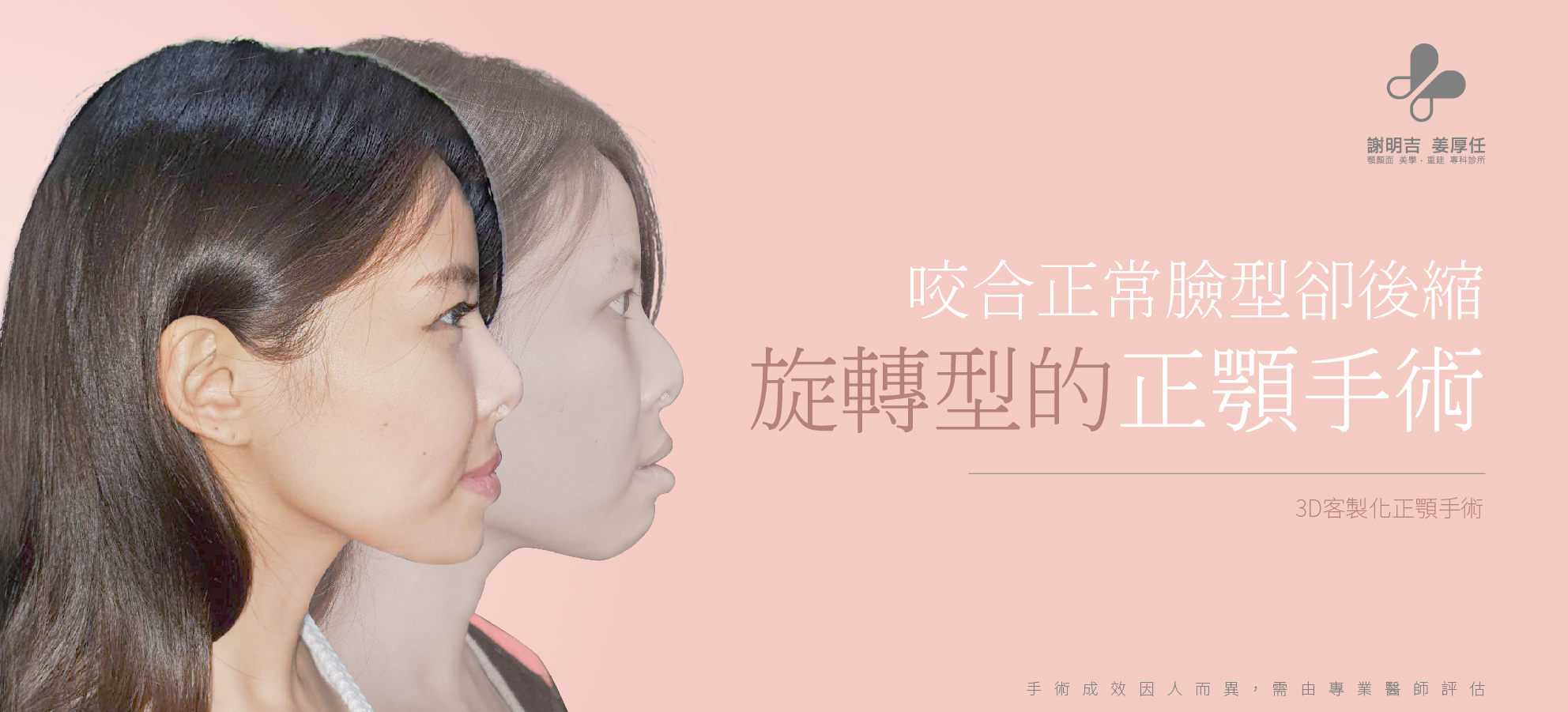 Zi Yi