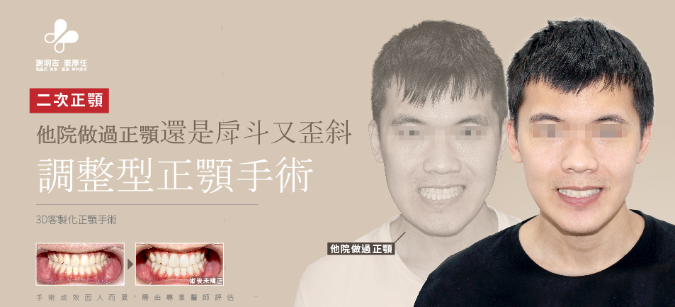 Hsieh MW