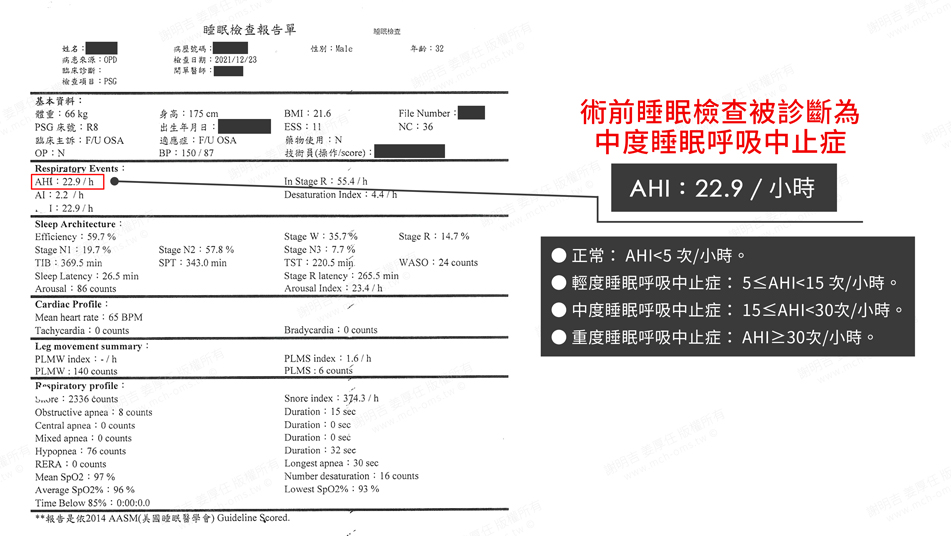 WWN 術前術後對比 17