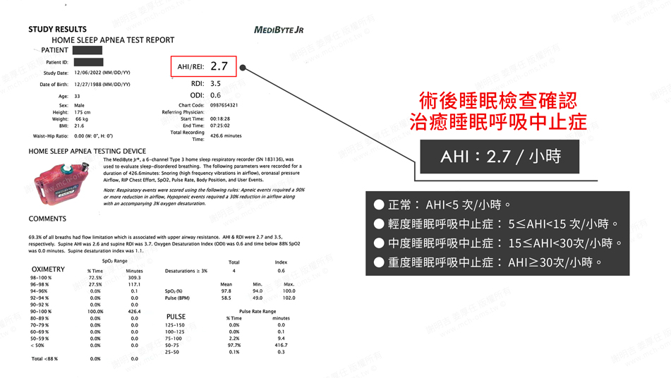 WWN 術前術後對比 18