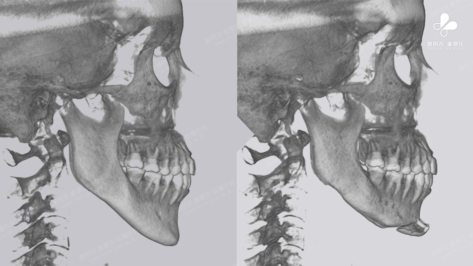 Mrs. Chang before and after comparison 5