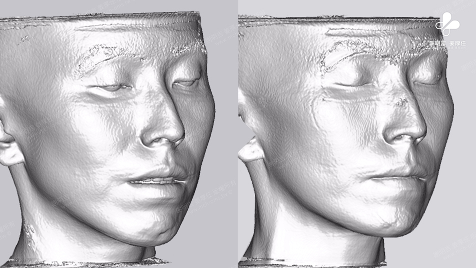 Mrs. Chang before and after comparison 6